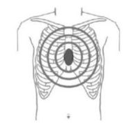 胸骨圧迫の場所のイラスト