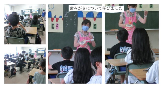 ブラッシング指導
