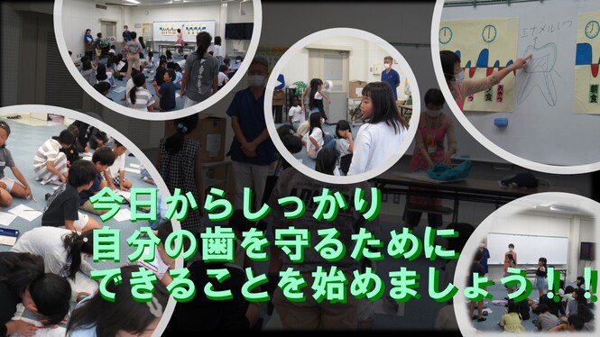 ブラッシング指導