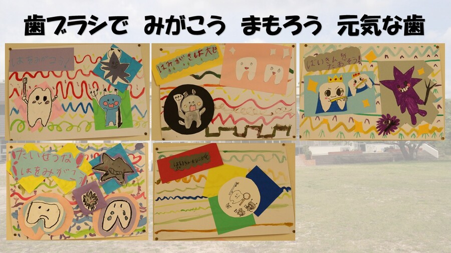 歯科検診