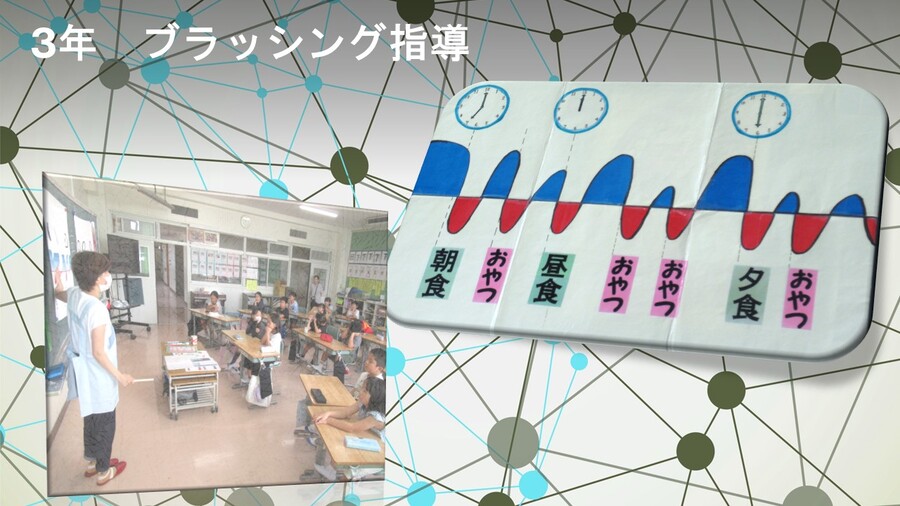 ブラッシング指導