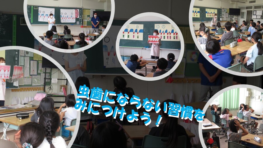 ブラッシング指導